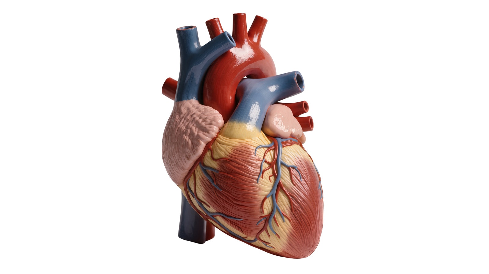 An expandable artificial heart valve designed for children